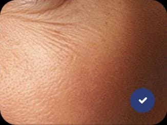 Close-up of skin texture and fine lines