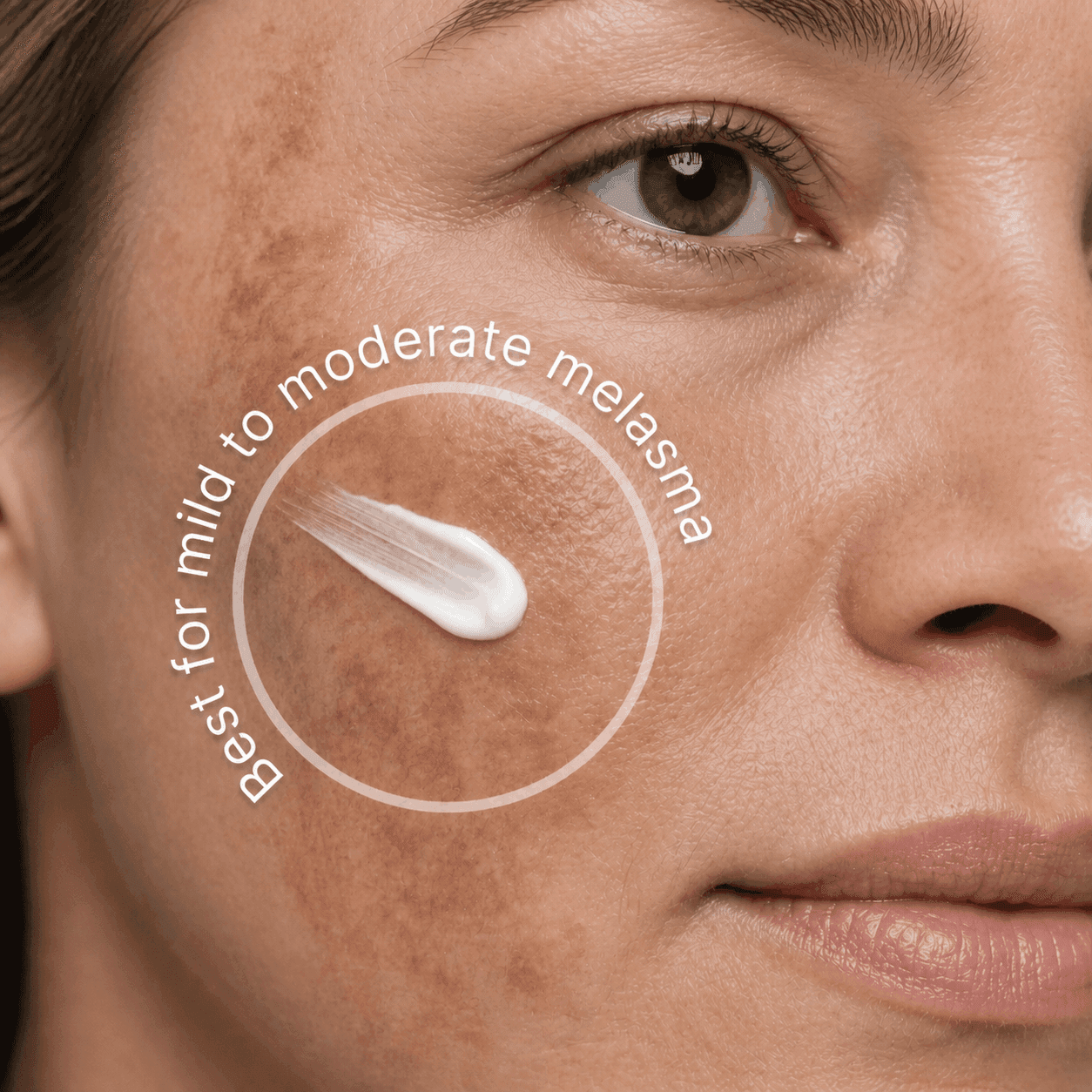 The Dark Spot Solution best for mild to moderate melasma