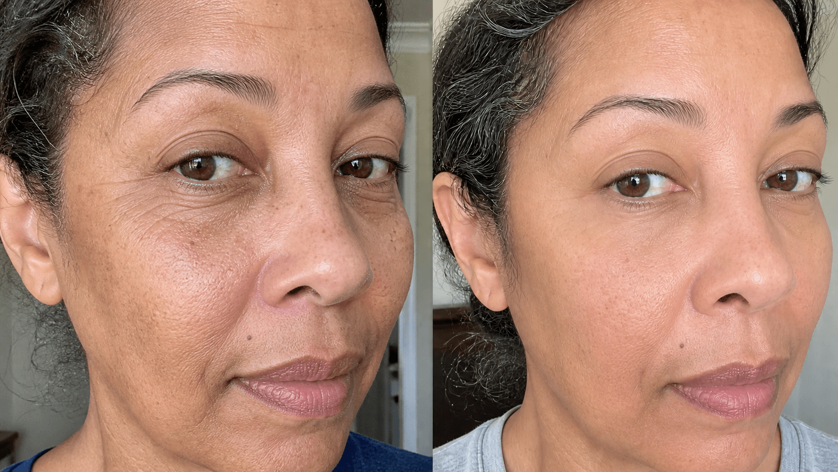 Angela's skin before and after using The Advanced Anti-Aging Solution