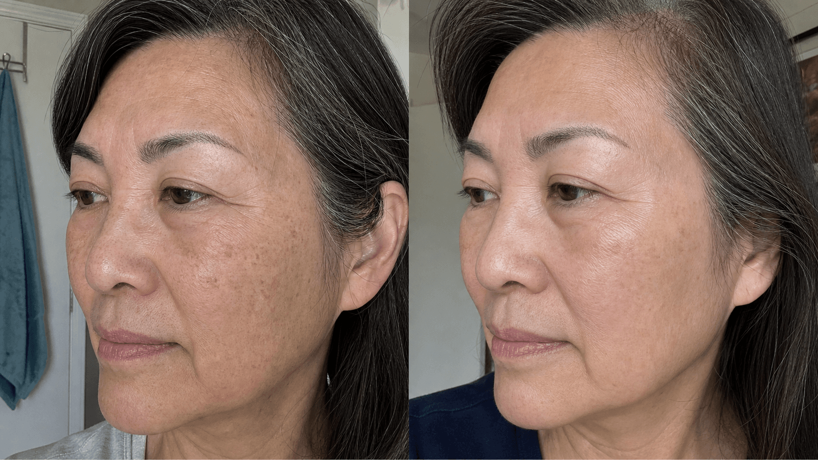 Diane's skin before and after using The Advanced Anti-Aging Solution