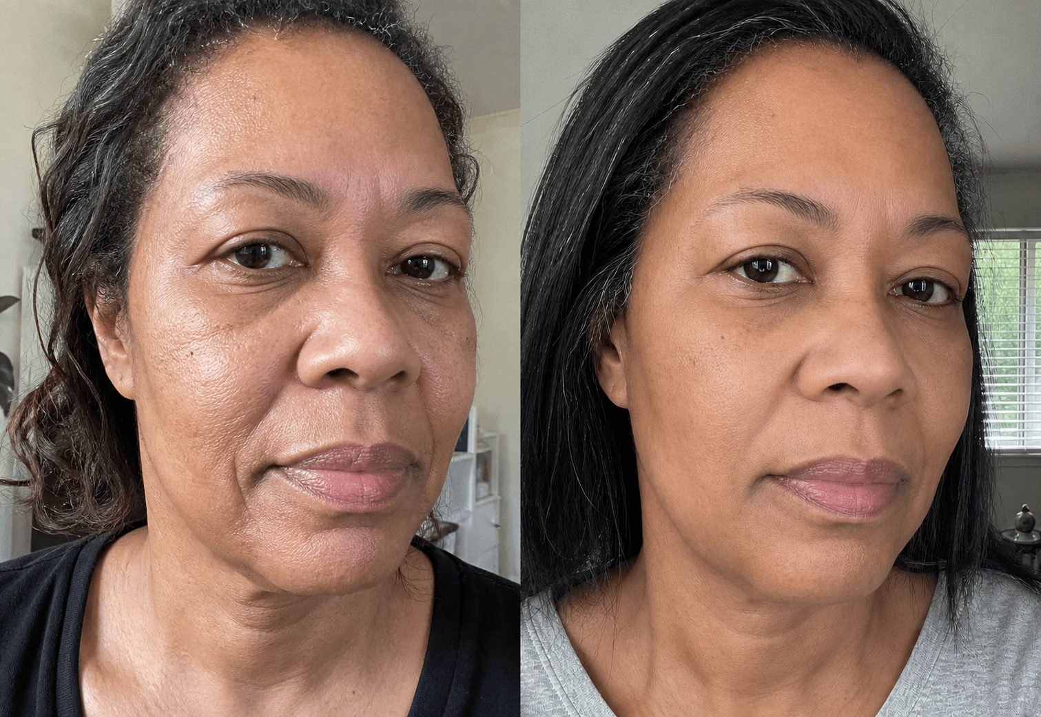 Michelle's skin before and after using The Advanced Anti-Aging Solution