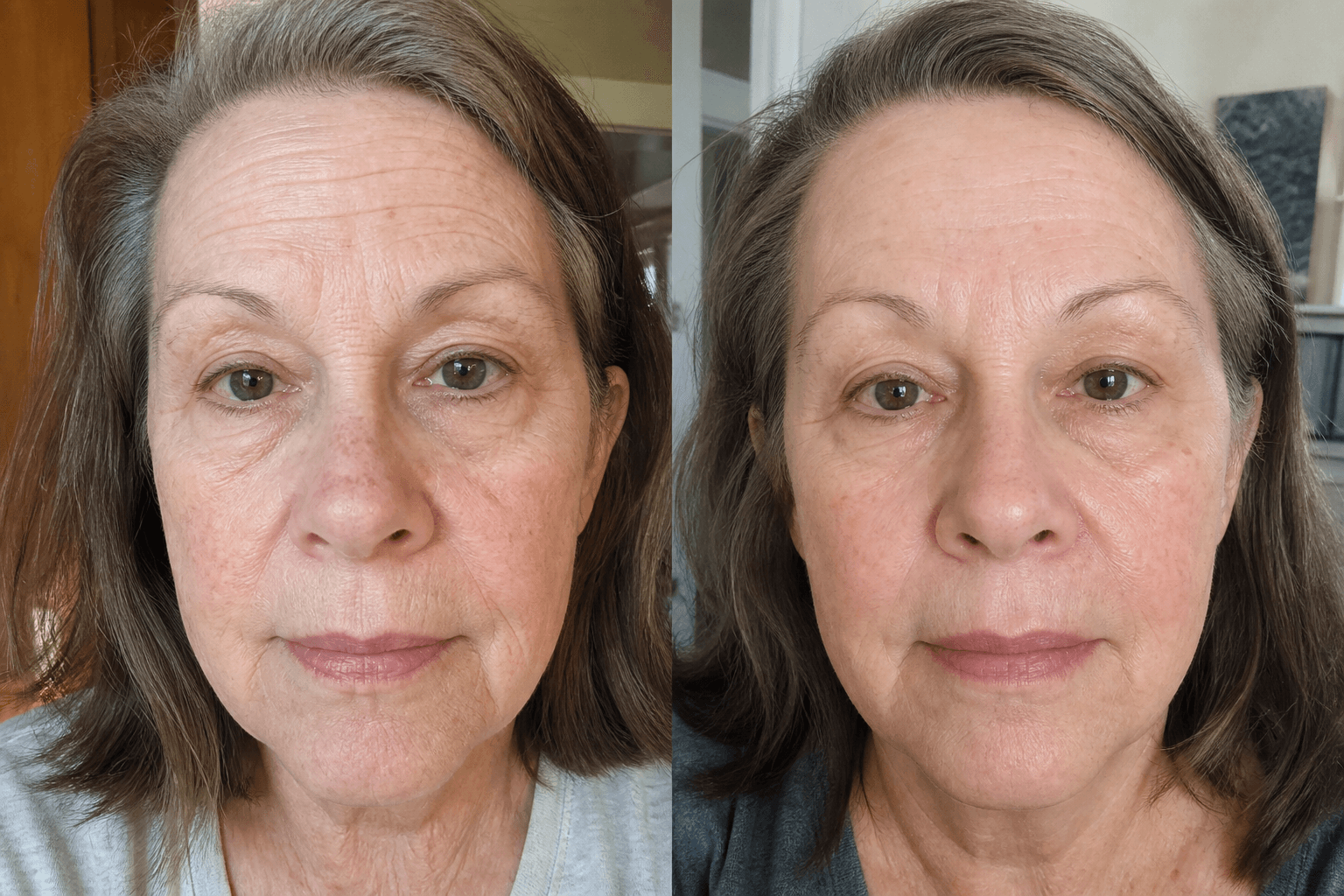 Patricia's skin before and after using The Advanced Anti-Aging Solution
