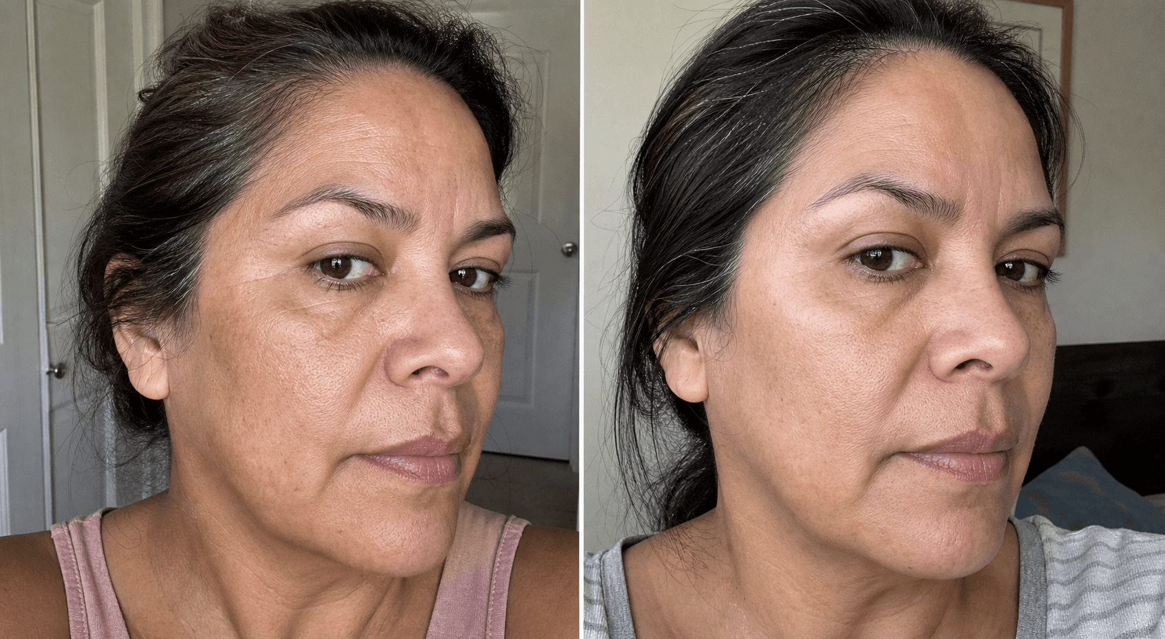 Vanessa's skin before and after using The Advanced Anti-Aging Solution