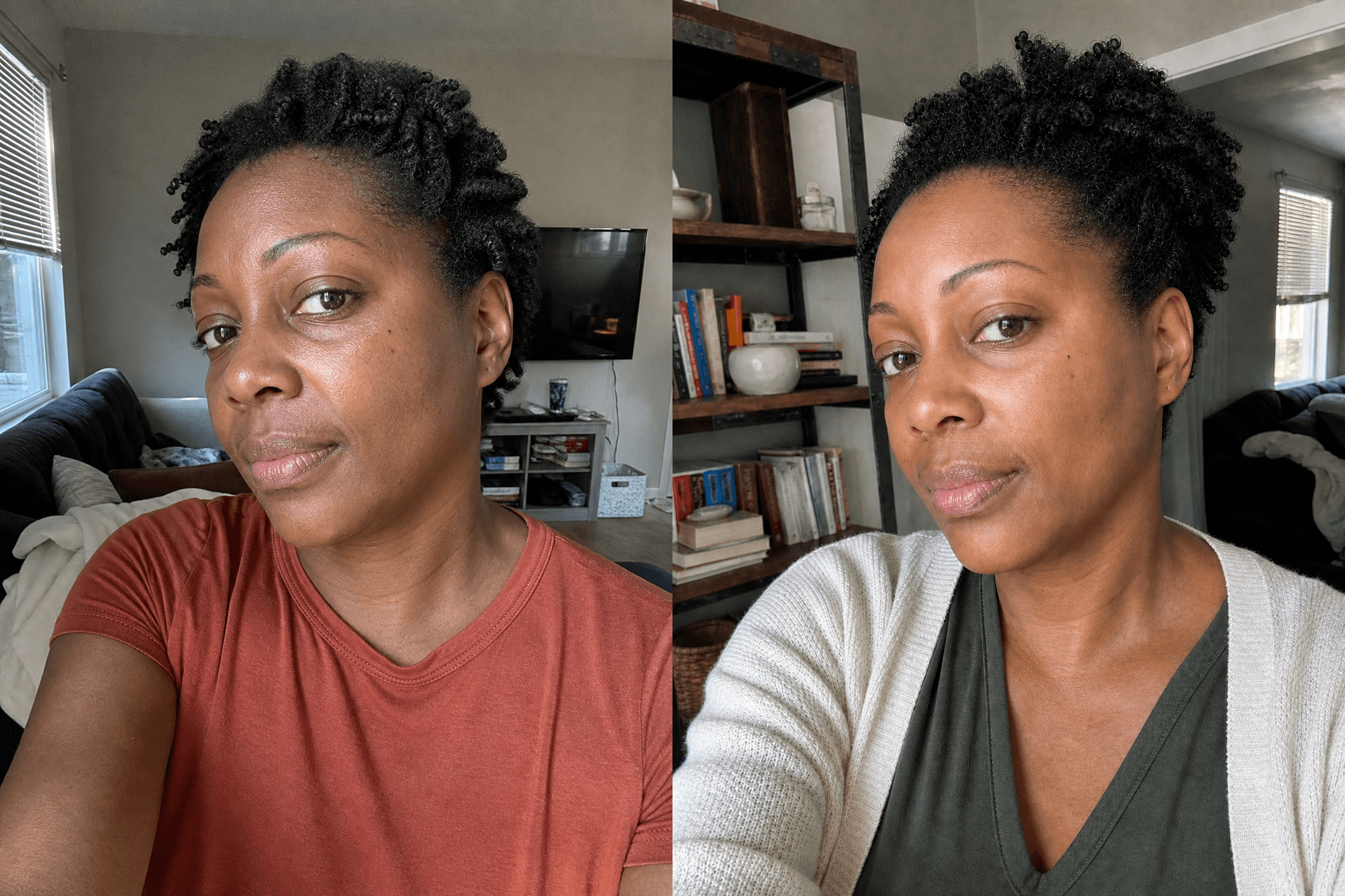 Simone's skin before and after using The Anti-Aging Solution