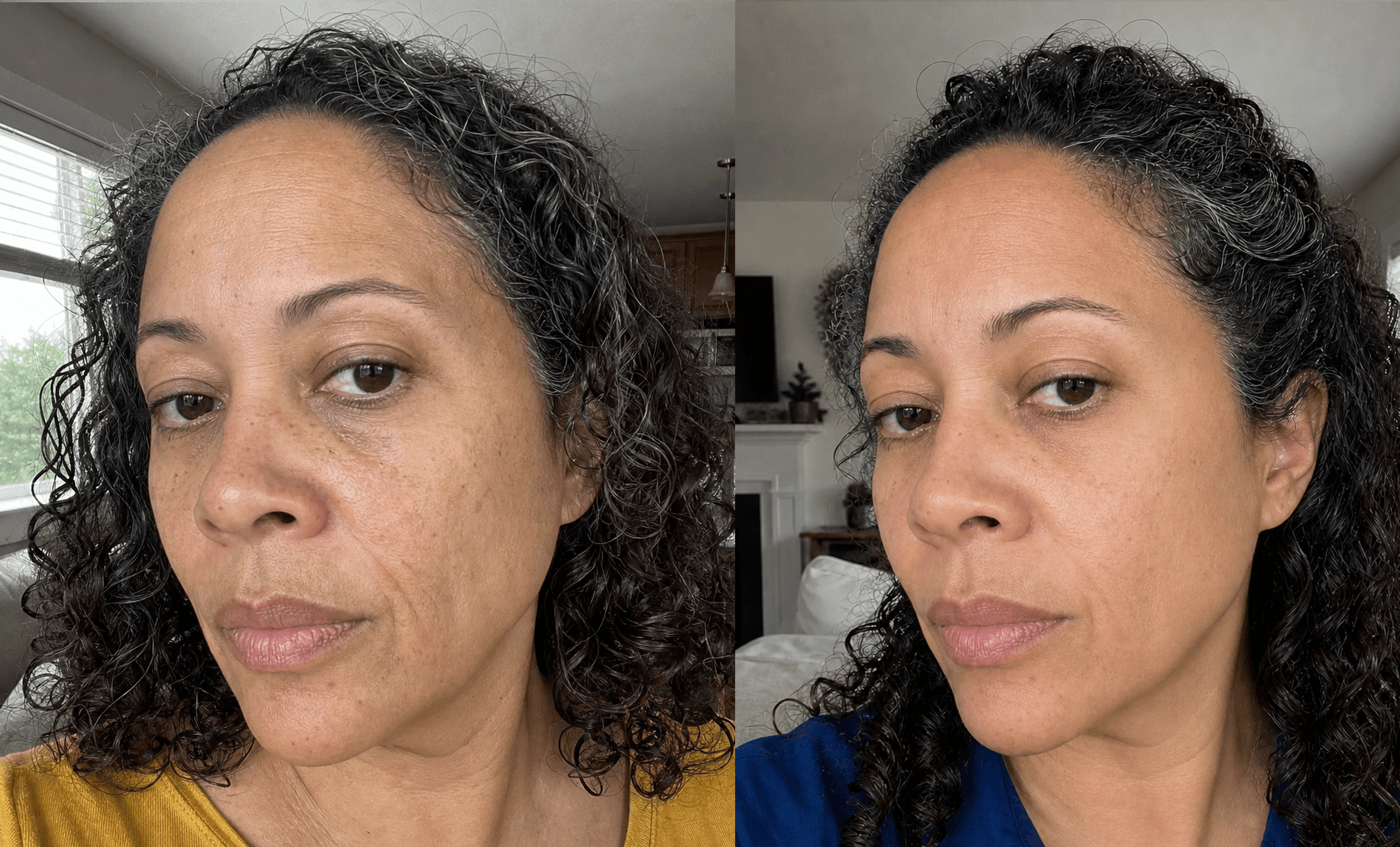 Jessica's skin before and after using The Anti-Aging Solution