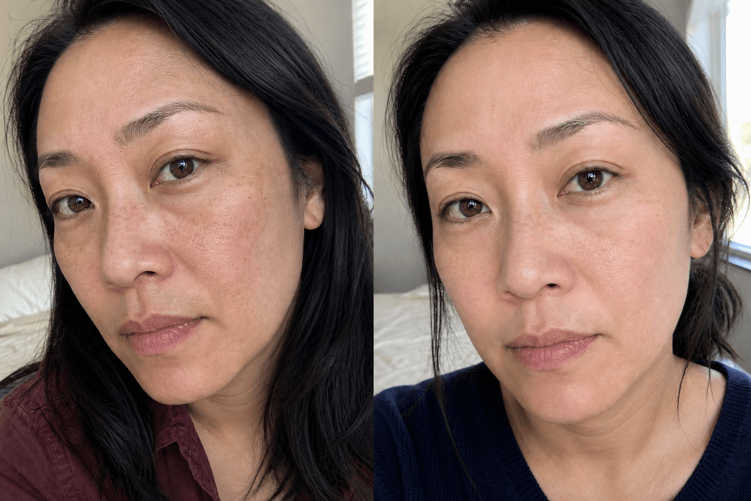 Lauren's skin texture before and after using The Anti-Aging Solution