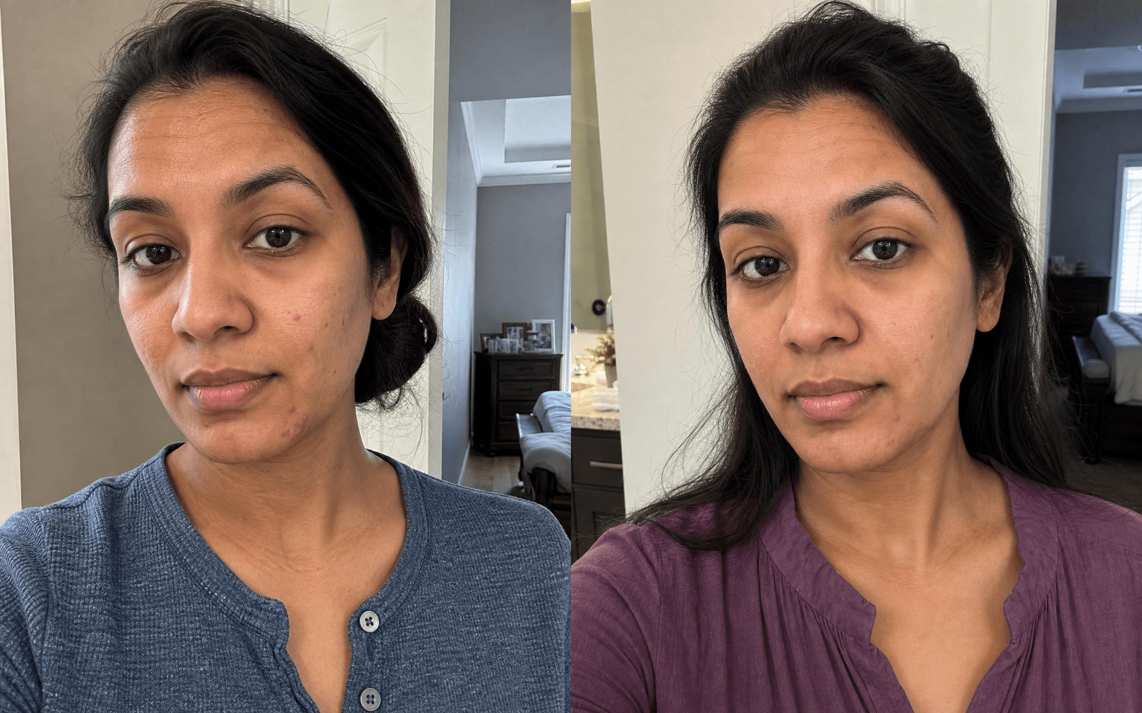Erica's skin before and after using The Anti-Aging Solution