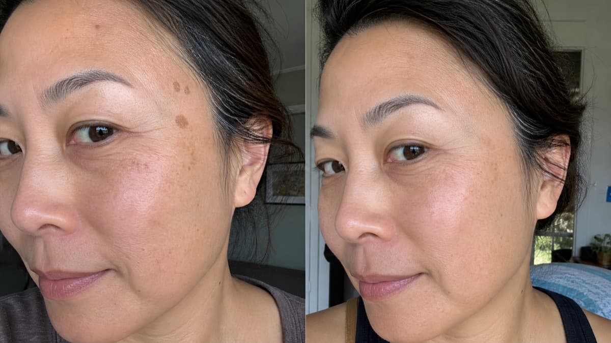 Maya's temple sun spots before and after using The Precision Dark Spot Corrector