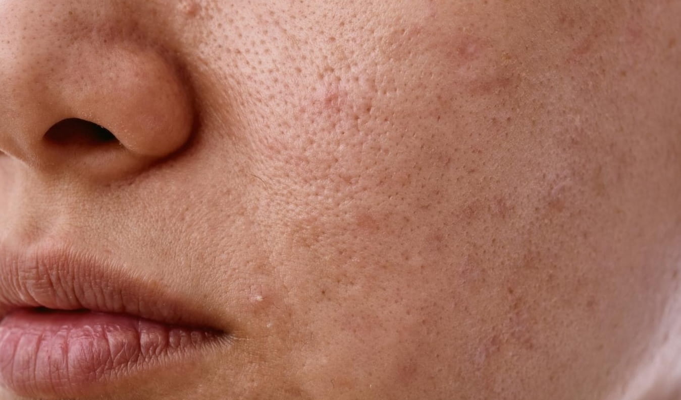 Close-up of dull, tired-looking skin