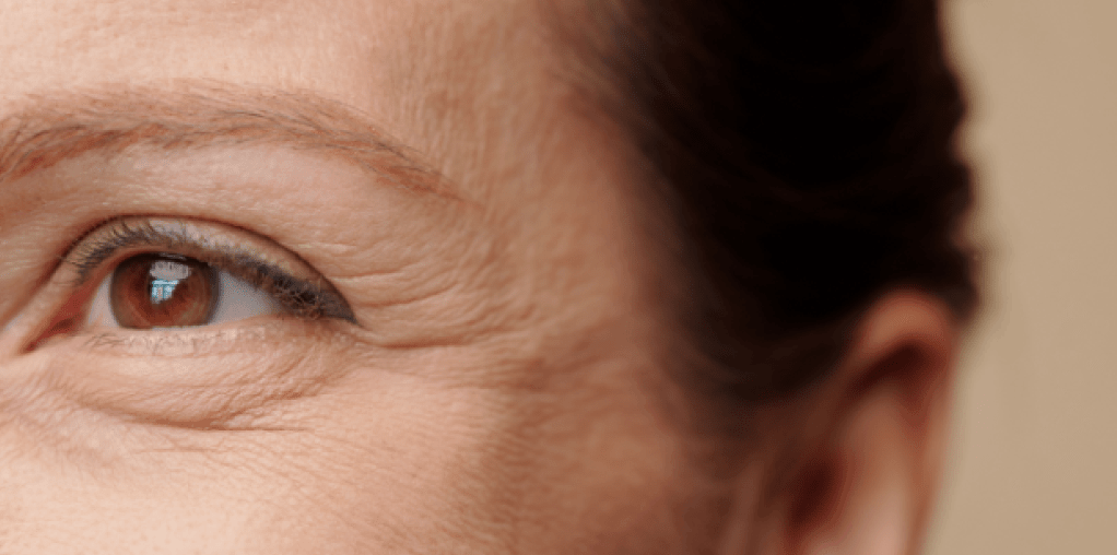 Close-up of fine lines around the eye area